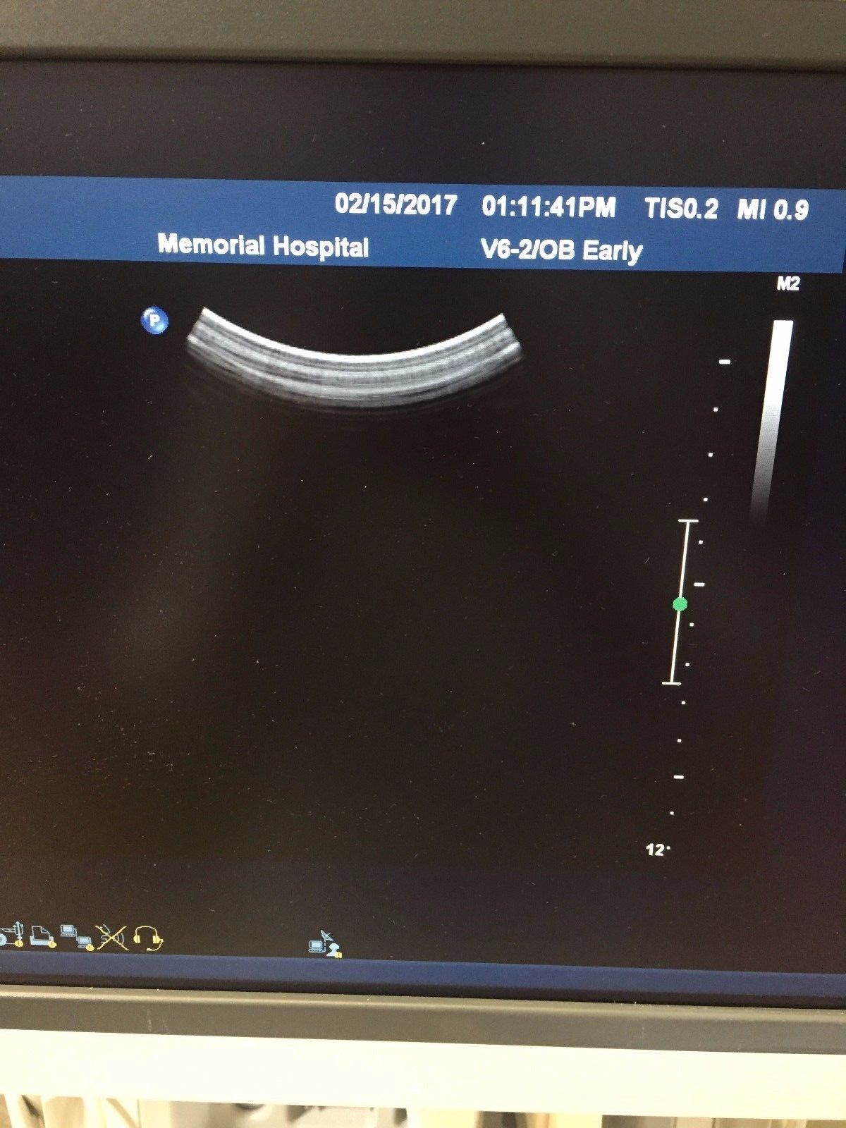 monitor display