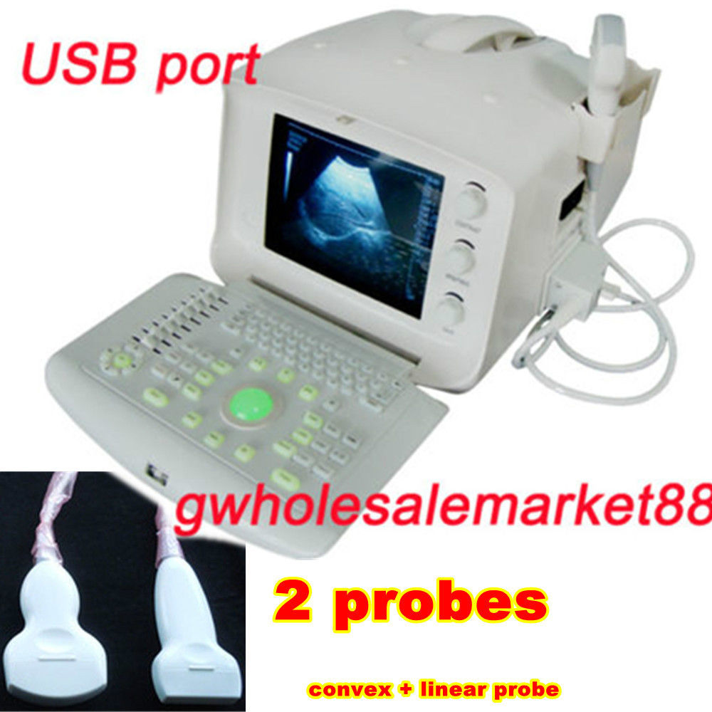 Medical 3D Portable Ultrasound Diagnose Scanner Convex Linear transvaginal Probe DIAGNOSTIC ULTRASOUND MACHINES FOR SALE