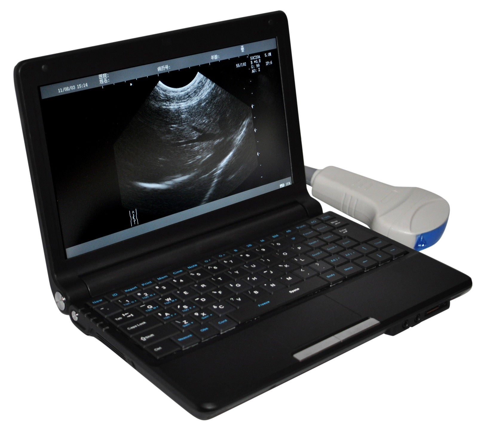 Digital Portable Ultrasound Machine Scanner System Convex Probe + 3D + Oximeter DIAGNOSTIC ULTRASOUND MACHINES FOR SALE