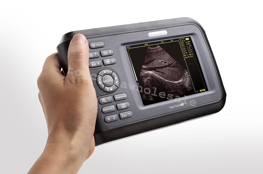 PalmSmart 5.5''Color TFT Digital Ultrasound Scanner Scan Tester+Linear Probe CE DIAGNOSTIC ULTRASOUND MACHINES FOR SALE