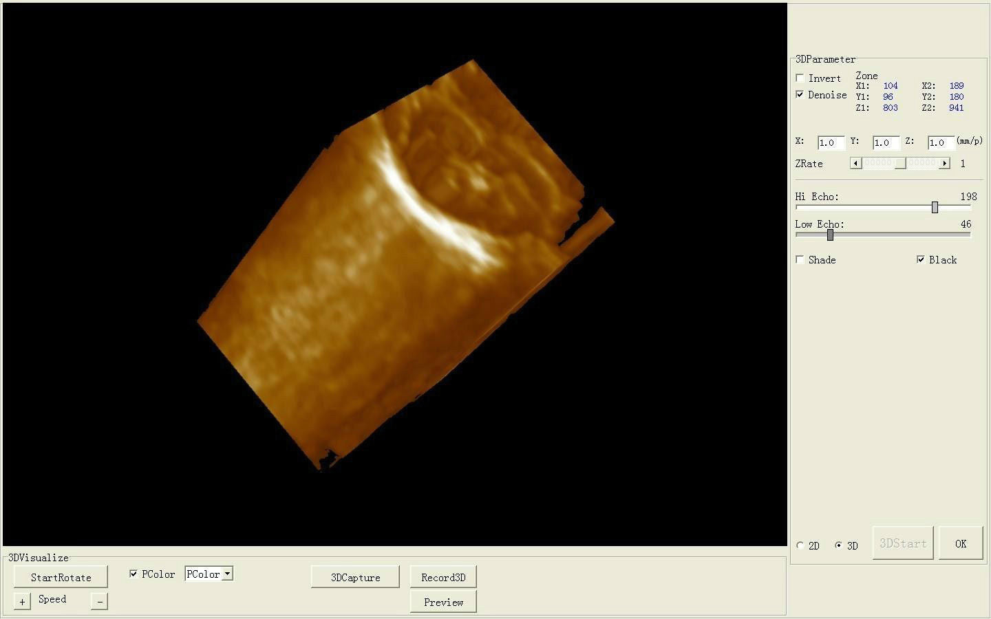 New VGA Digital 3D Image Diagnostic Ultrasound Scanner Convex +Linear 2 probe DIAGNOSTIC ULTRASOUND MACHINES FOR SALE