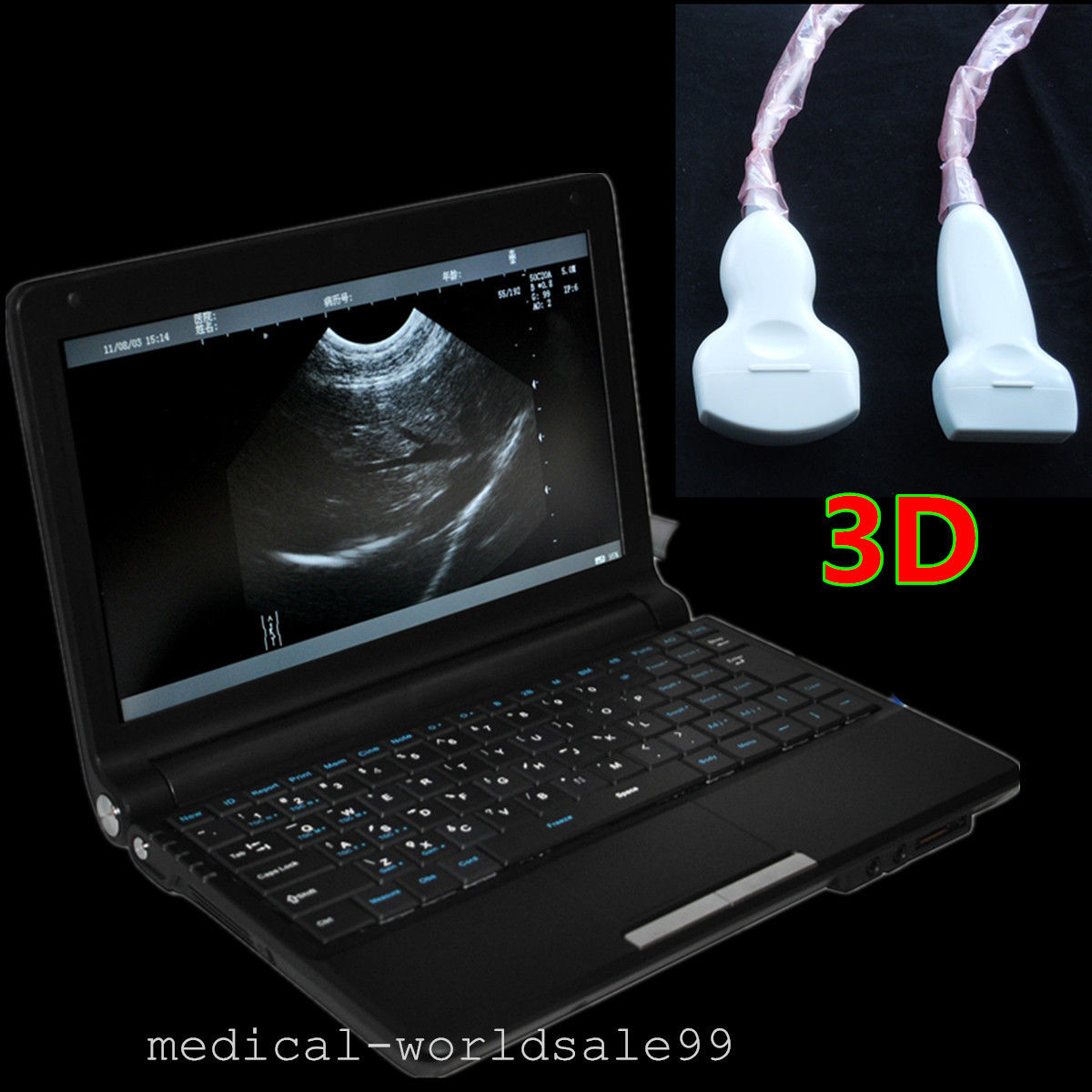 Free 3D Laptop Ultrasonic Ultrasound Scanner Convex & Linear 2 Probes Sale 190891435422 DIAGNOSTIC ULTRASOUND MACHINES FOR SALE