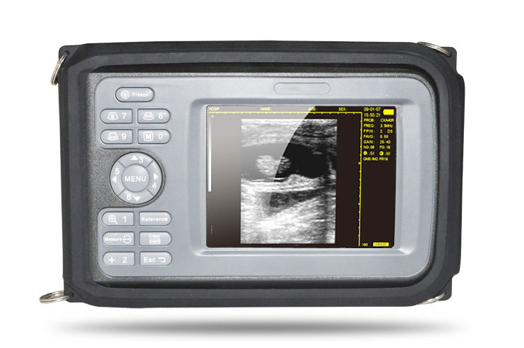 Laptop Machine HandScan Ultrasound scanner Convex + Linear+ Micro convex 3 Probe DIAGNOSTIC ULTRASOUND MACHINES FOR SALE