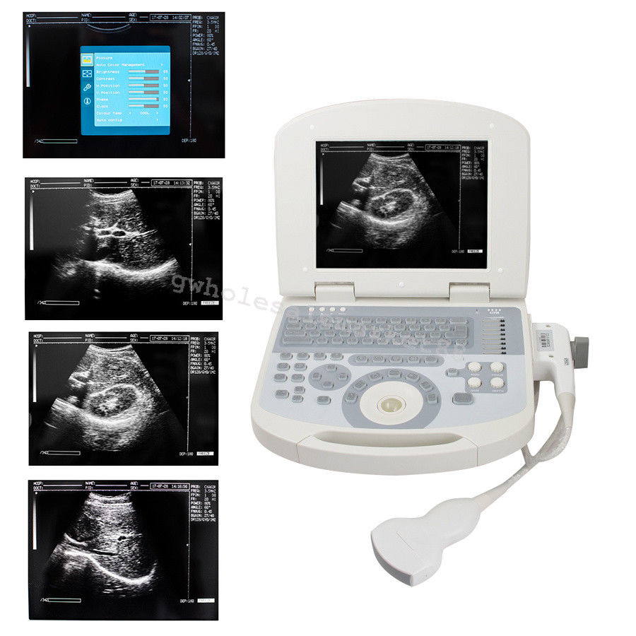 Laptop Ultrasound Machine Scanner System Convex probe+ 3D Workstation 96 Element 190891045898 DIAGNOSTIC ULTRASOUND MACHINES FOR SALE