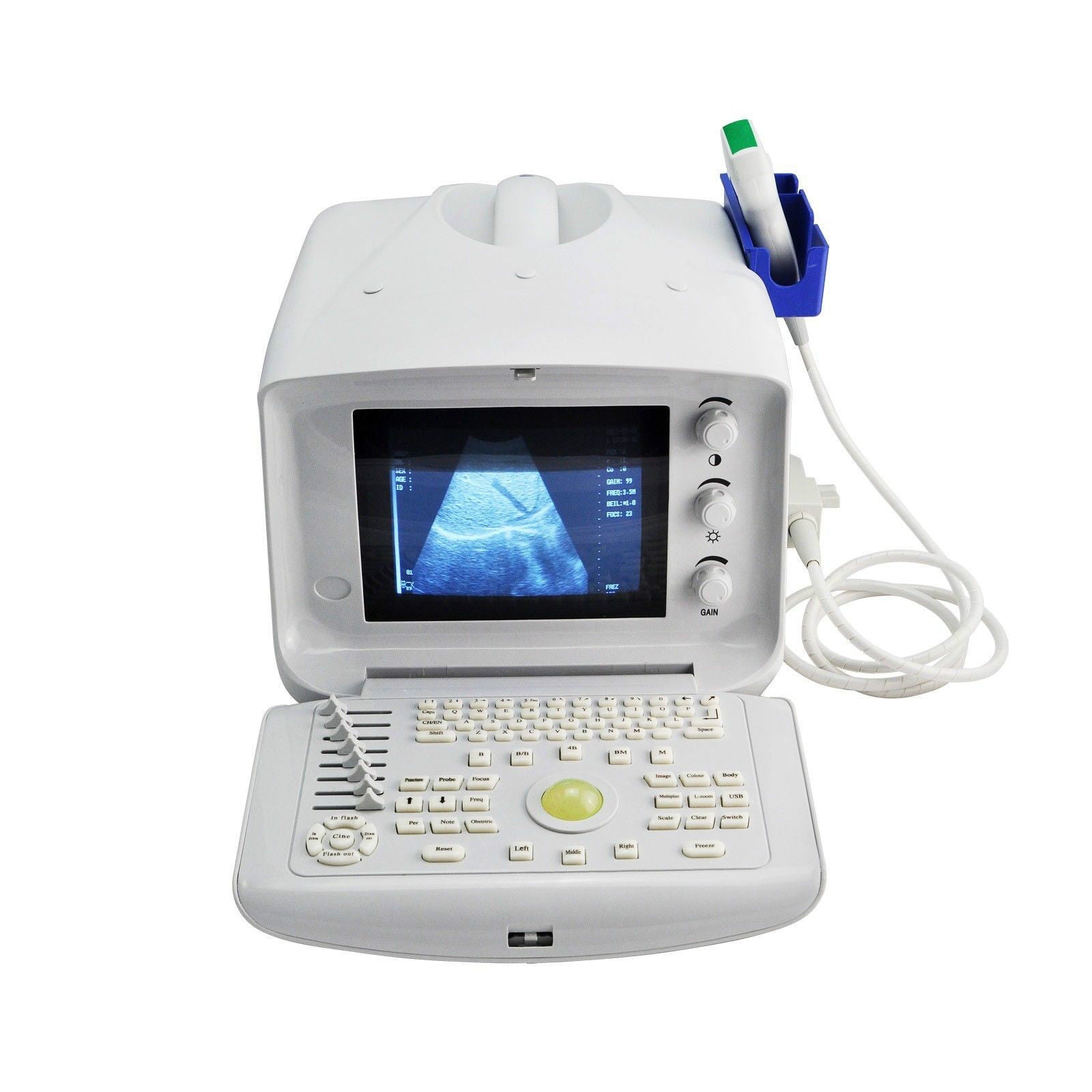Medical 3D Portable Ultrasound Diagnose Scanner Convex Linear transvaginal Probe DIAGNOSTIC ULTRASOUND MACHINES FOR SALE
