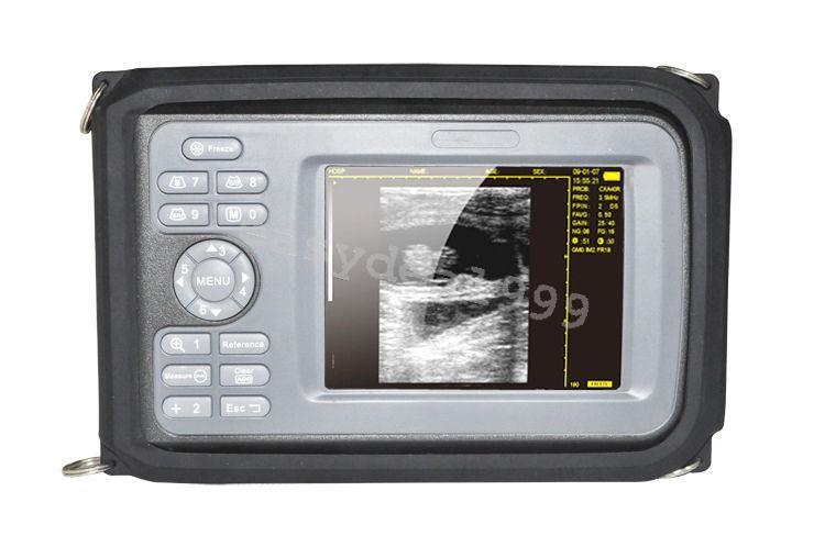 Portable Handheld Digital Ultrasound Scanner Transvaginal Probe Battery AC Case DIAGNOSTIC ULTRASOUND MACHINES FOR SALE
