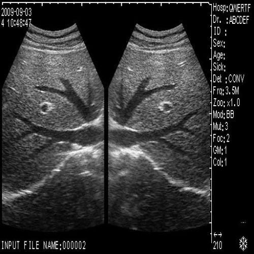 Diagnostic Ultrasound Scanner Machine Convex +Transvaginal 2 Probe Free 3D Extra 190891422446 DIAGNOSTIC ULTRASOUND MACHINES FOR SALE