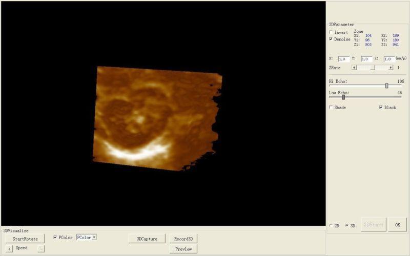 Full Digital Portable Ultrasound Scanner Machine + Linear Probe + 3D Software CE DIAGNOSTIC ULTRASOUND MACHINES FOR SALE