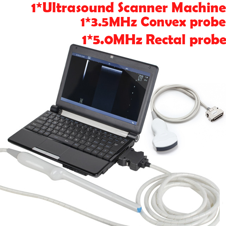 Digital Laptop Machine Ultrasound Scanner 7.5MHz Linear Probe Transvaginal Probe DIAGNOSTIC ULTRASOUND MACHINES FOR SALE