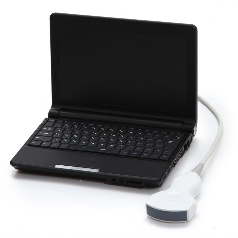 Laptop Ultrasound Scanner Diagnostic DiagnosisMachine Convex Probe Sale CE DIAGNOSTIC ULTRASOUND MACHINES FOR SALE