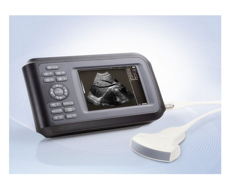 Digital LCD Check System Ultrasound Scanner Monitoring with linear Probe US Ship 190891417756 DIAGNOSTIC ULTRASOUND MACHINES FOR SALE