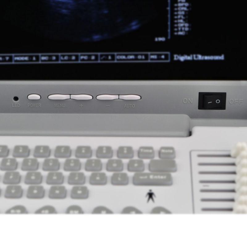 Full Digital Laptop Machine Ultrasound Scanner +Transvaginal Probe+3D Worksation 190891867513 DIAGNOSTIC ULTRASOUND MACHINES FOR SALE
