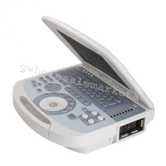 Portable Ultrasound Machine Scanner System Convex probe 3D Software Image Photo 190891045898 DIAGNOSTIC ULTRASOUND MACHINES FOR SALE