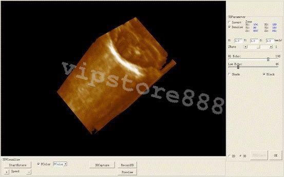 Digital Ultrasound Scanner Machine  +Convex +Vaginal + Linear 3 Probes/Sensor+3D DIAGNOSTIC ULTRASOUND MACHINES FOR SALE