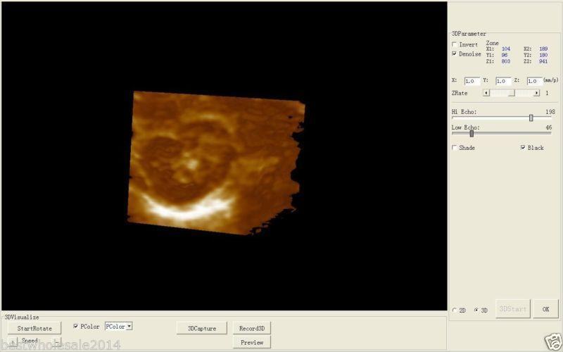 Laptop Ultrasound Scanner Diagnostic DiagnosisMachine Convex Probe Sale CE DIAGNOSTIC ULTRASOUND MACHINES FOR SALE