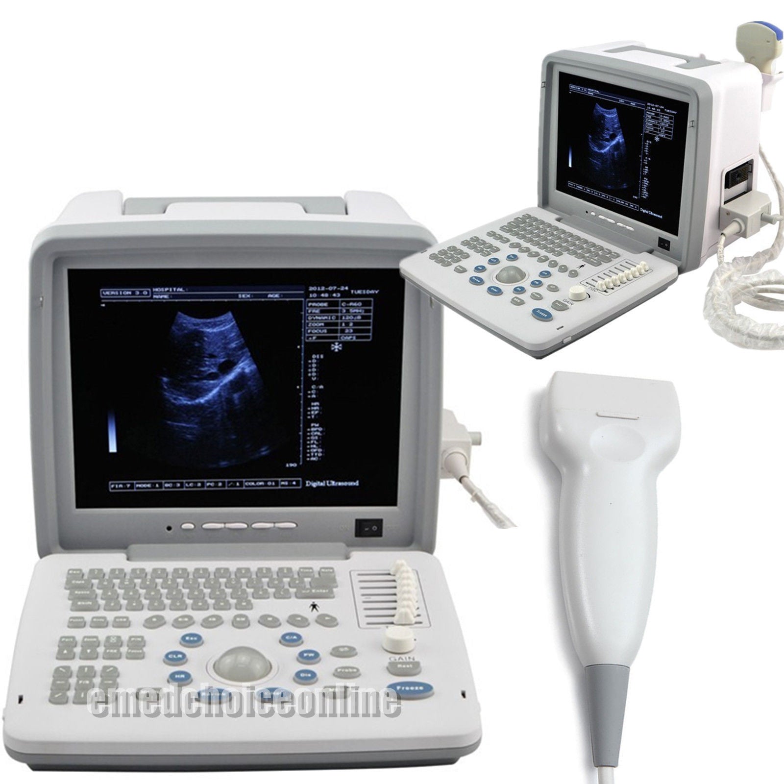 Portable Ultrasound Scanner Ultrasound Machine with Linear Probe Best Image Sale 190891482020 DIAGNOSTIC ULTRASOUND MACHINES FOR SALE