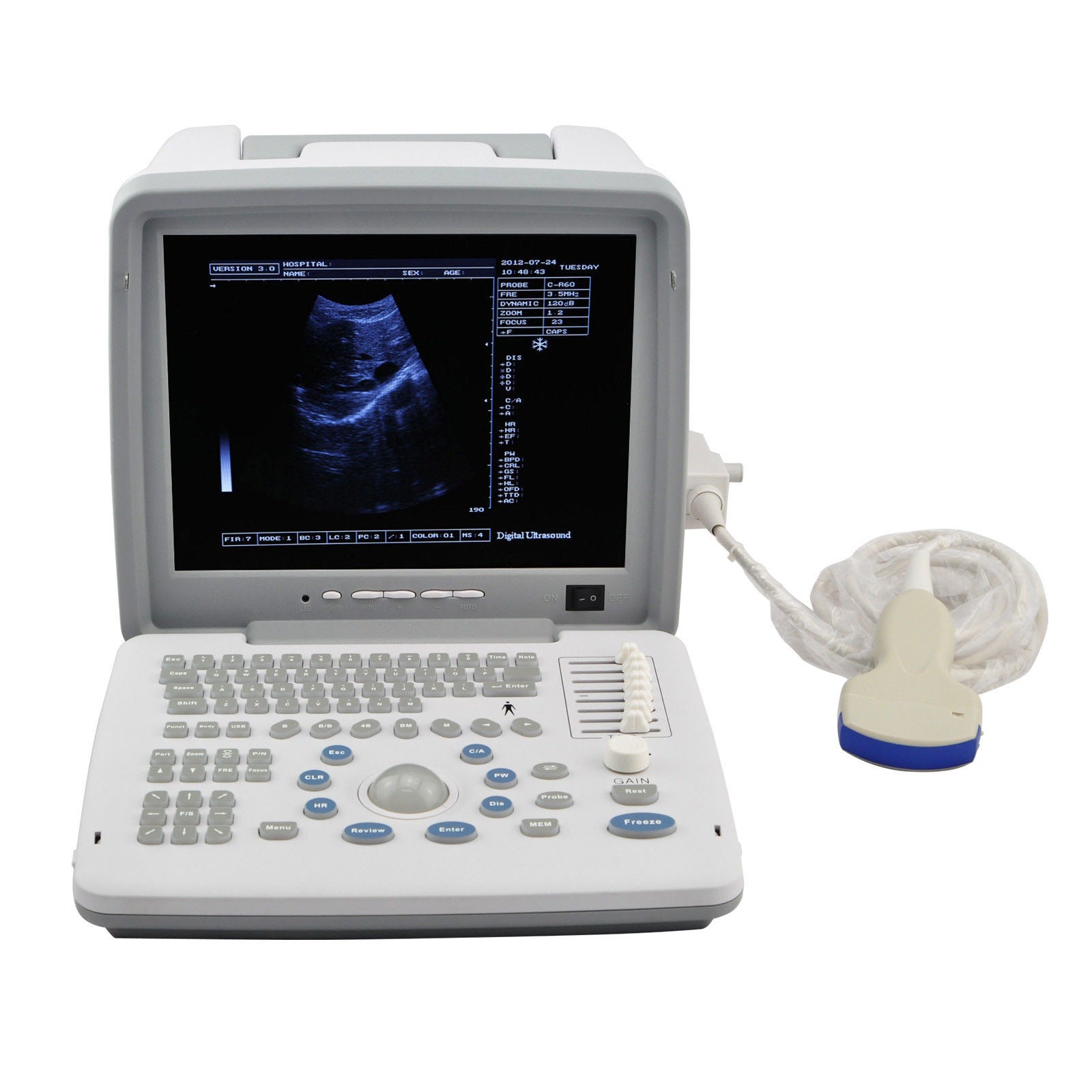 Digital Portable Ultrasound Scanner Machine + 7.5MHz Linear Probe 3D UPS Fast 190891523907 DIAGNOSTIC ULTRASOUND MACHINES FOR SALE