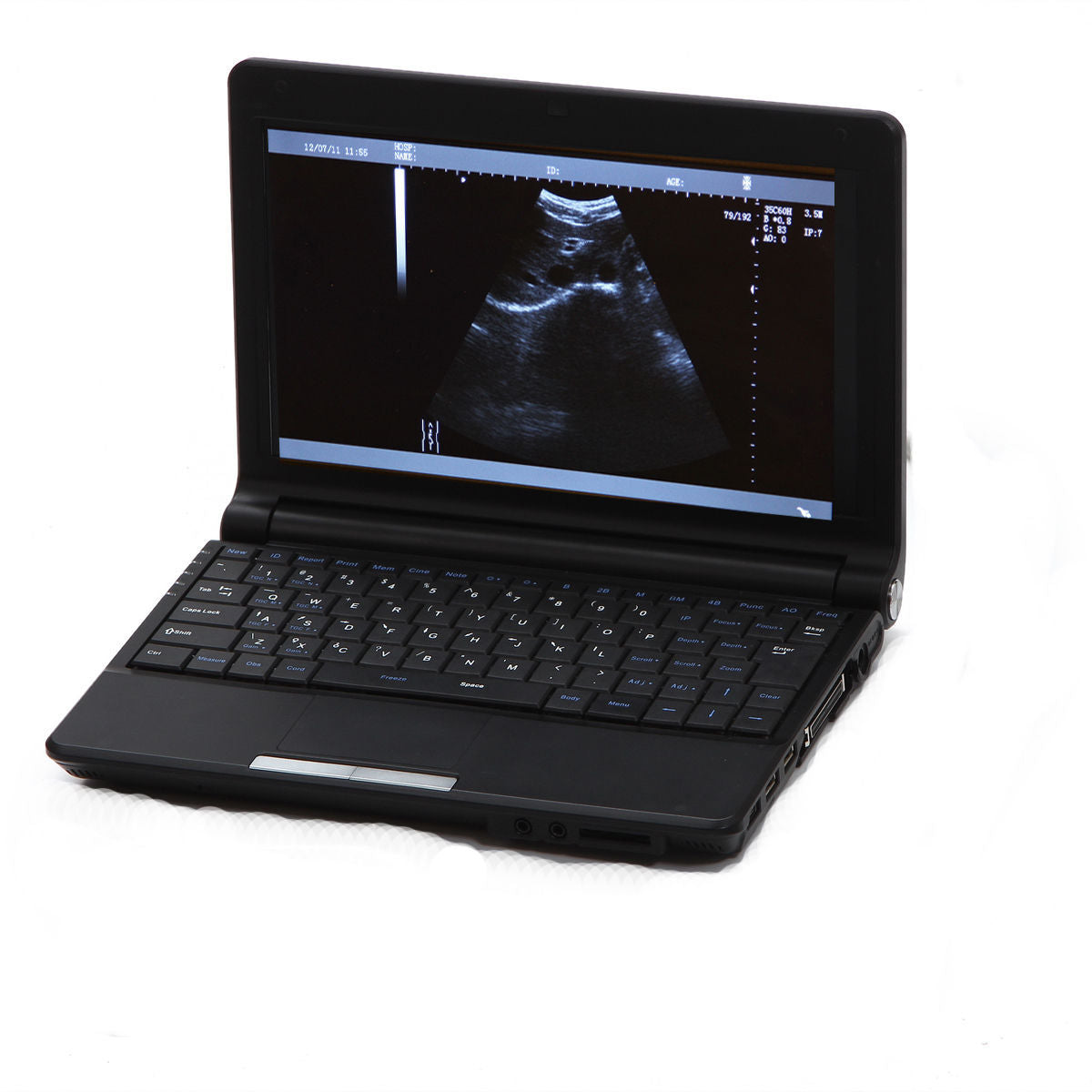 Digital Portable Ultrasound Machine Scanner System Convex Probe + 3D + Oximeter DIAGNOSTIC ULTRASOUND MACHINES FOR SALE