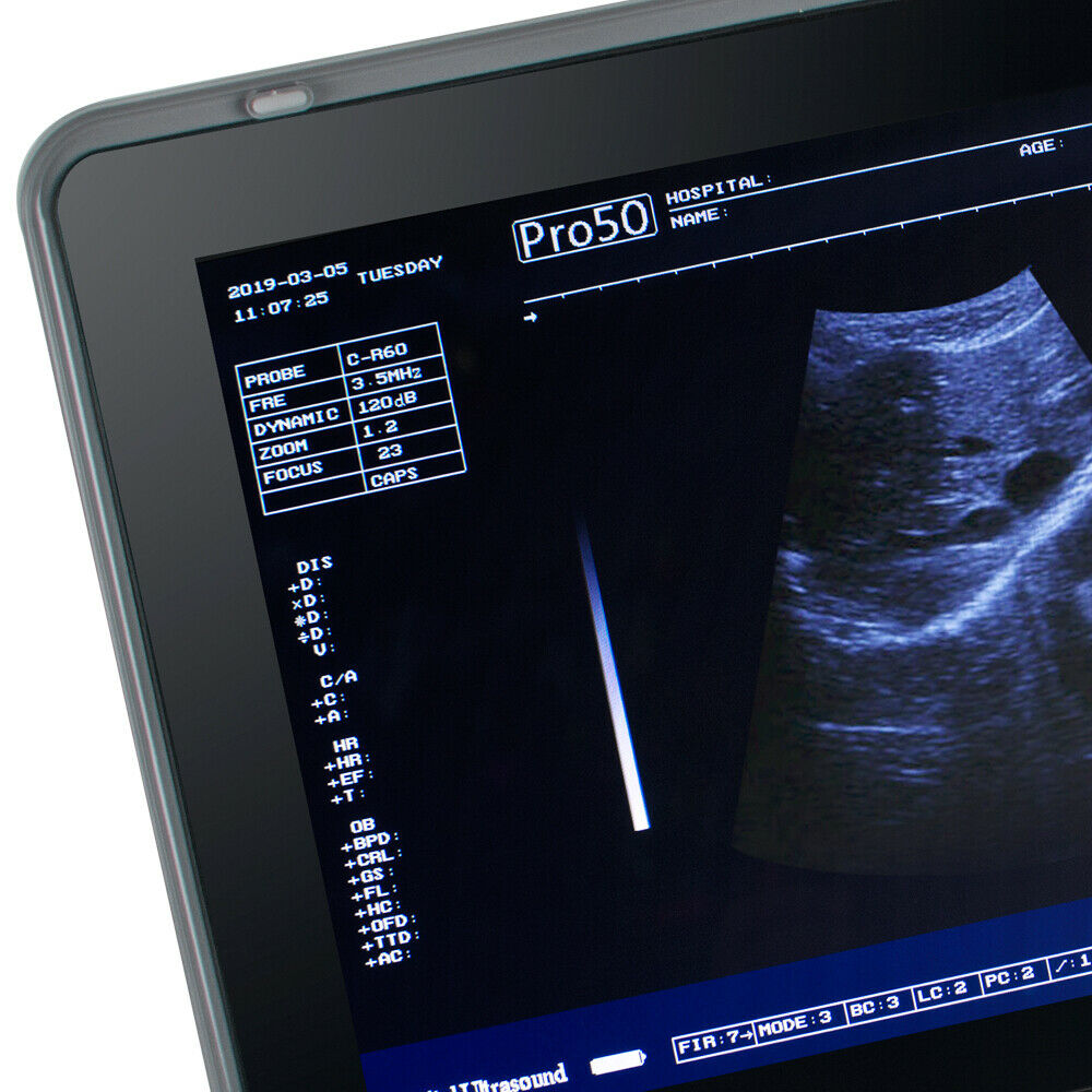 Portable Ultrasound Scanner Laptop Machine Safty Ultrasonic System+Convex Probe DIAGNOSTIC ULTRASOUND MACHINES FOR SALE