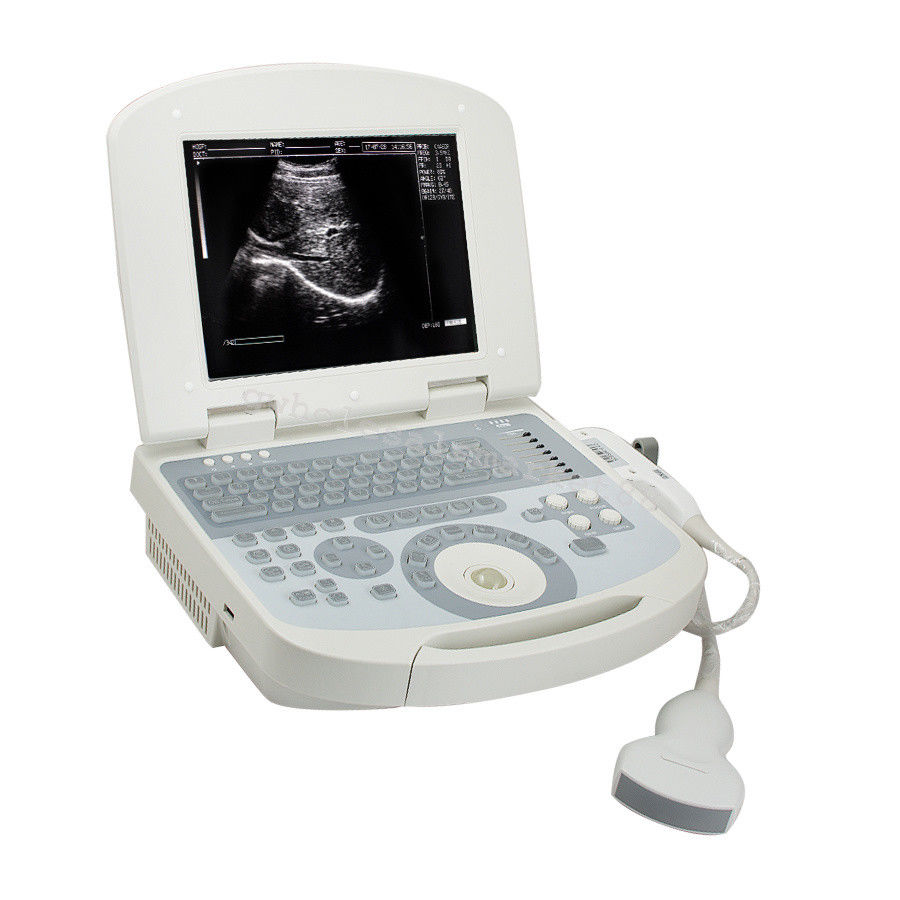 Portable Ultrasound Machine Scanner System Convex probe 3D Software Image Photo 190891045898 DIAGNOSTIC ULTRASOUND MACHINES FOR SALE