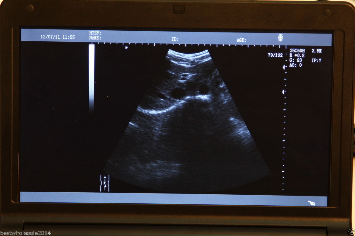 Laptop Ultrasound Scanner Diagnostic DiagnosisMachine Convex Probe Sale CE DIAGNOSTIC ULTRASOUND MACHINES FOR SALE
