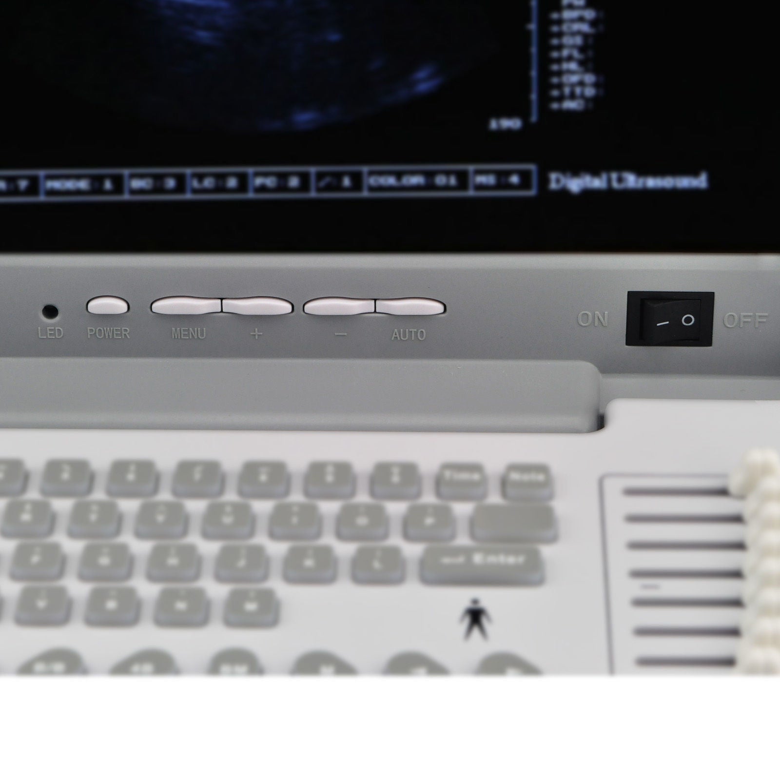 Digital Portable Ultrasound Scanner Machine + Convex & Transvaginal 2 Probes DHL DIAGNOSTIC ULTRASOUND MACHINES FOR SALE